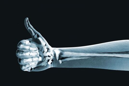 Ακτινογραφία για τη διάγνωση του πόνου στις αρθρώσεις των δακτύλων